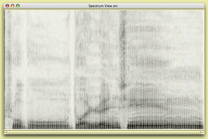 sonogram